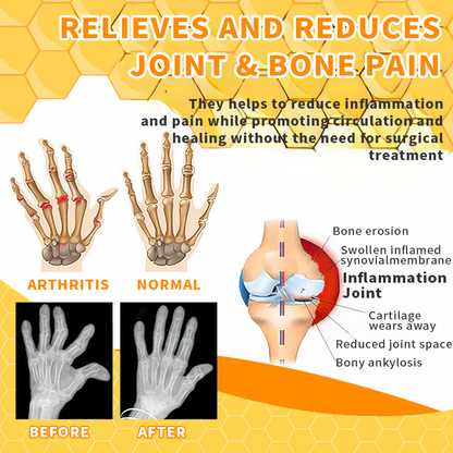 💎💎 AQA™ Bee Venom Joint Therapy Pain Relief Gel (New Zealand Bee Extract - Specializes in Orthopedic Diseases and Arthritis Pain)