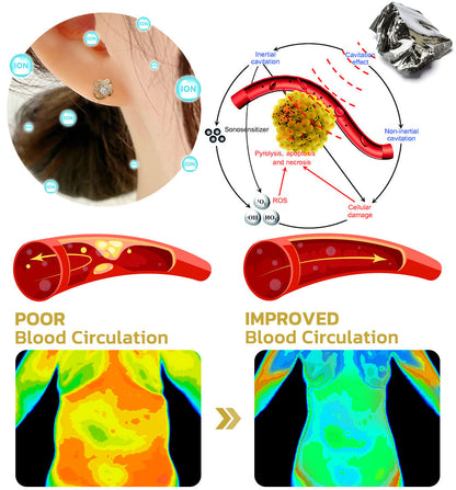 (🔥LAST DAY SALE-80% OFF)Histone Lymphvity MagneTherapy Germanium Earrings