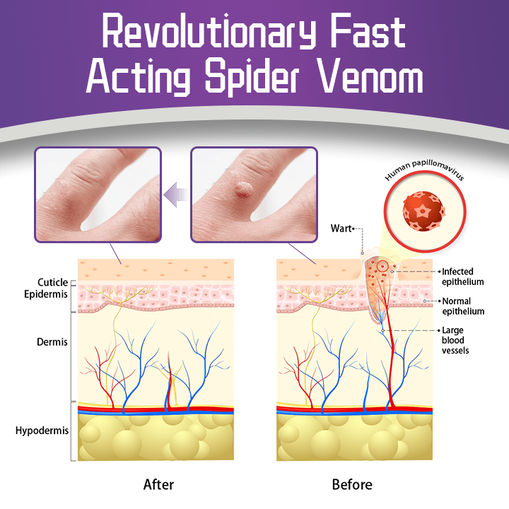 AQA™ Spider Venom Skin Smoothing Care Serum