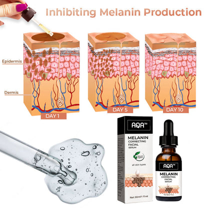 (Official Brand Store】 AQA™ Melanin Correcting Facial Serum-Tags & Moles & Dark Spot Remover