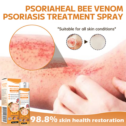 AQA™ PsoriaHeal Bee Venom Psoriasis Treatment Spray(Suitable for all skin conditions)